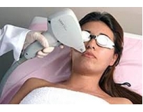 clínica de depilação a laser buço em Perus