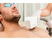 clínica de depilação a laser para homem na Lapa