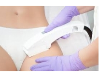 clínica de depilação a laser virilha na Vila Gustavo