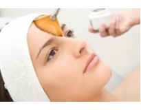 clínica de tratamento para manchas do rosto no Tremembé
