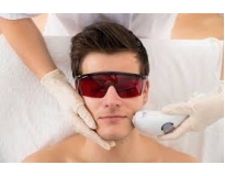 depilação a laser barba preço em Sumaré