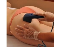 depilação a laser corporal preço em Perus