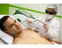 depilação a laser para homem preço em Brasilândia