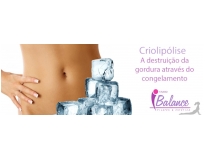 tratamento de criolipólise na Vila Leopoldina