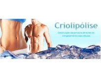 tratamentos corporal criolipólise na Vila Maria